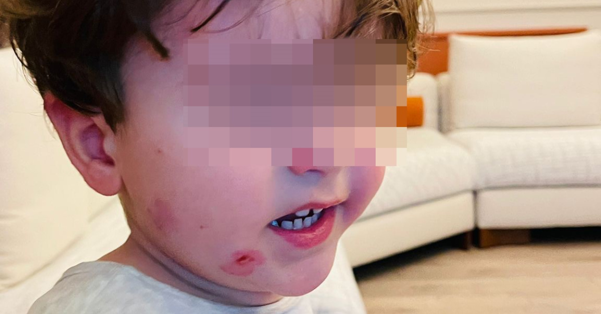 Bursa'da 2 Yaşındaki Çocuk Kreşte Darp Edildi