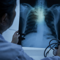 Ortadoğu'daki çatışmalar hava kalitesini vurdu! "Kirli havayı biz de soluyoruz"