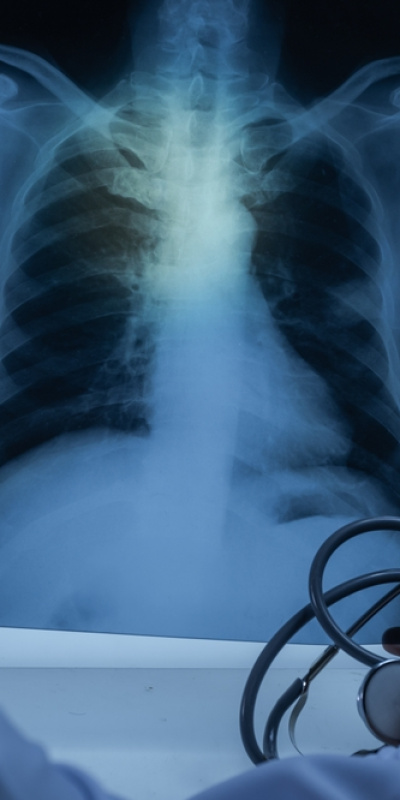 Ortadoğu'daki çatışmalar hava kalitesini vurdu! "Kirli havayı biz de soluyoruz"