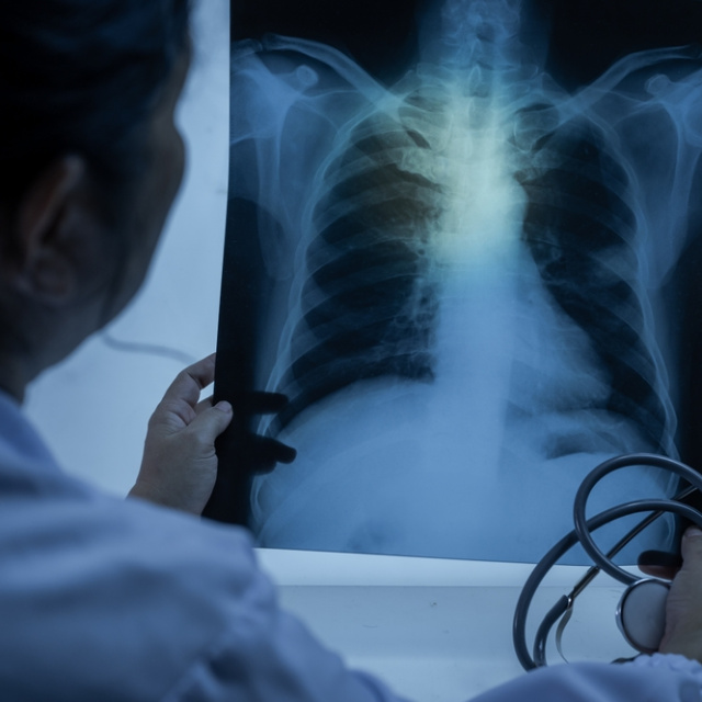 Ortadoğu'daki çatışmalar hava kalitesini vurdu! "Kirli havayı biz de soluyoruz"