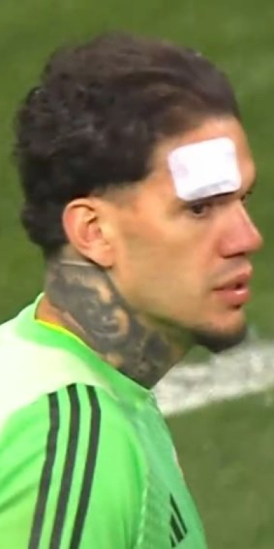 Ederson'a yabancı madde atıldı!