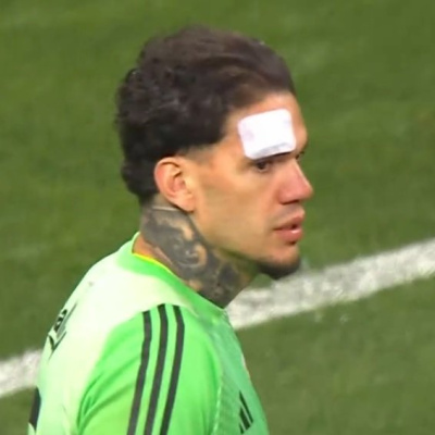 Ederson'a yabancı madde atıldı!