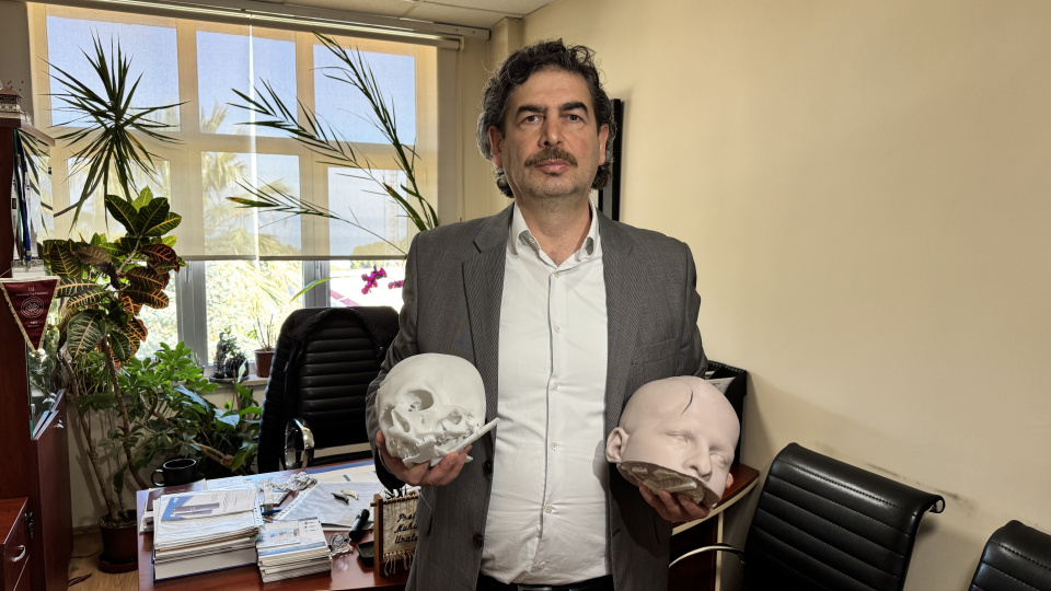 Yüzdeki şekil bozukluğu 3 boyutlu teknolojiyle düzeltildi