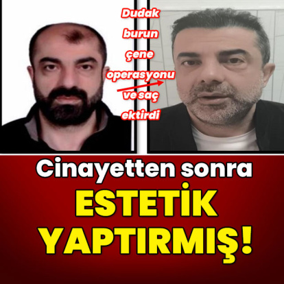 Cinayetin ardından estetik yaptırıp yüzünü değiştirdi!