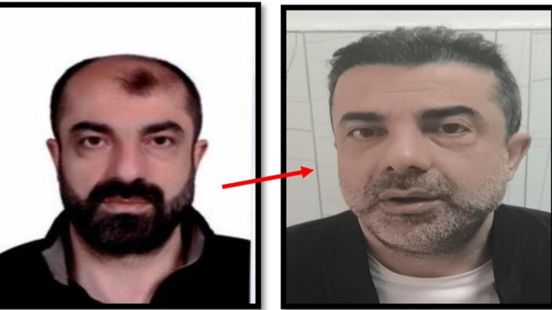 Cinayet Azmettiren Barış Mirza, Yüzünü Değiştirip Kardeşinin Kimliğiyle Yakalandı