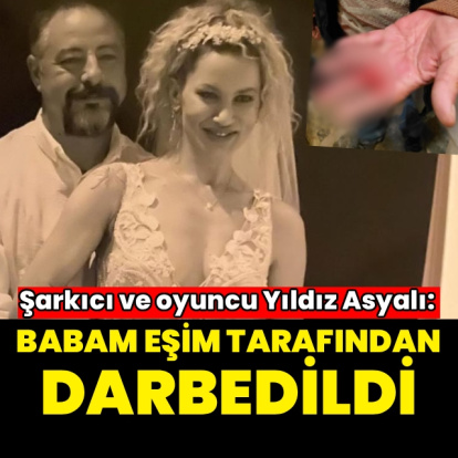 "Babam eşim tarafından darbedildi"