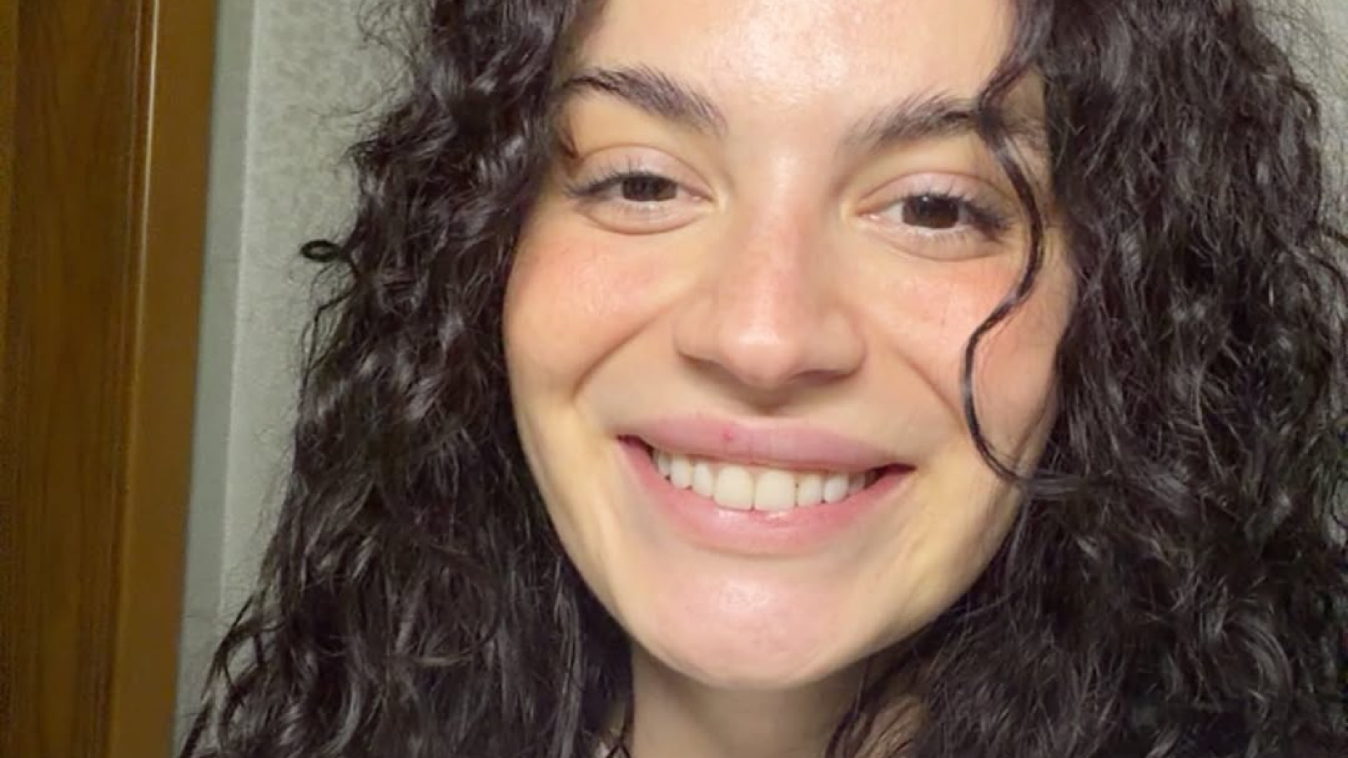 Yedi kez ameliyat olan Aslı Bekiroğlu'ndan sağlık durumu hakkında açıklama: Daha tam iyileşmedim - Magazin haberleri