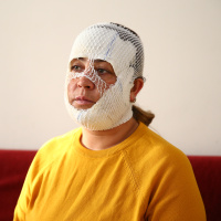 "Prenses bakım" 2. derece yanığa neden oldu