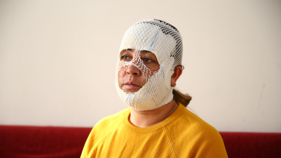 "Prenses bakım" 2. derece yanığa neden oldu