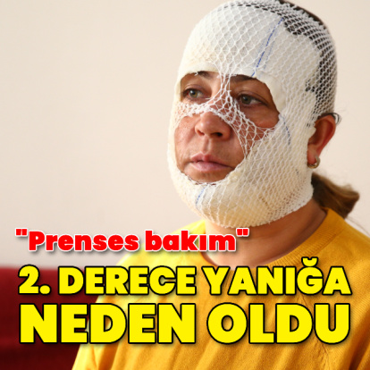 "Prenses bakım" 2. derece yanığa neden oldu