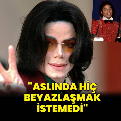 "Aslında hiç beyazlaşmak istemiyordu"