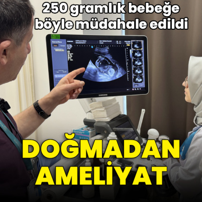 Doğmadan ameliyat! 250 gramlık bebeğe böyle müdahale edildi