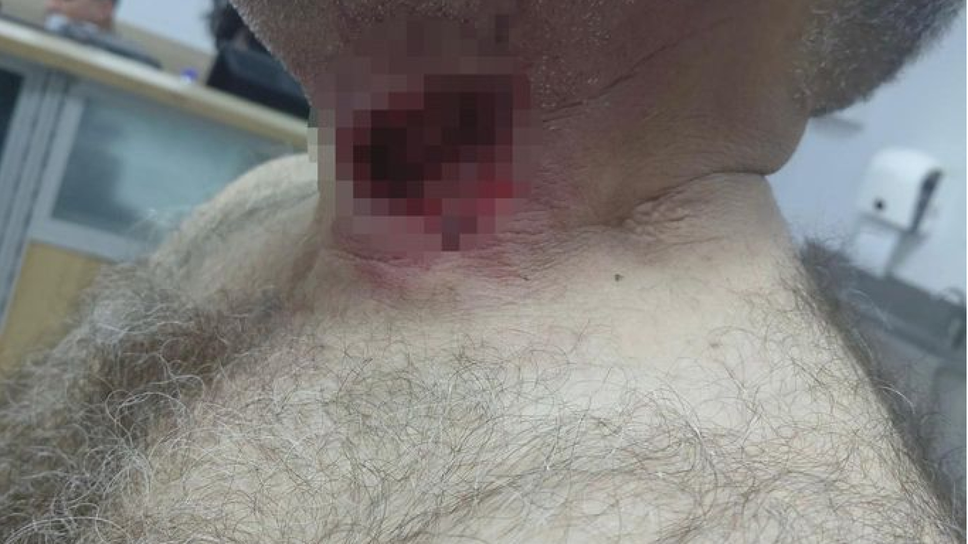 At sahibini boğazından ısırarak ağır yaraladı