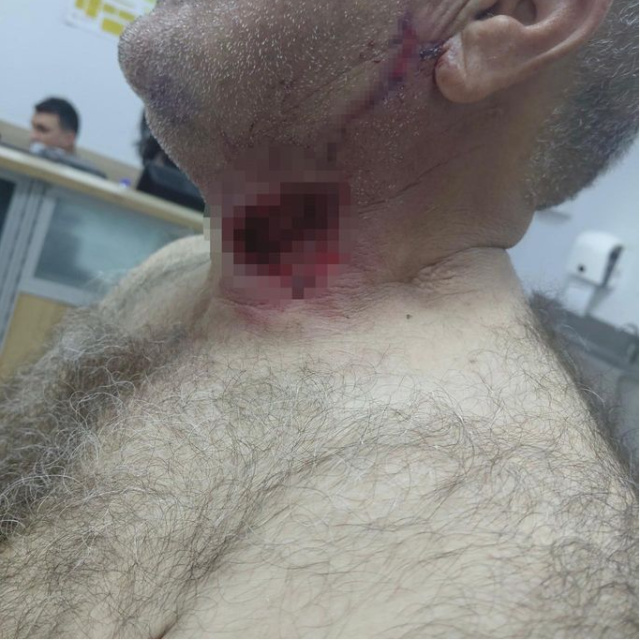 At boğazından ısırdı