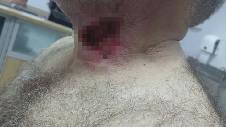 At, boğazından ısırdı