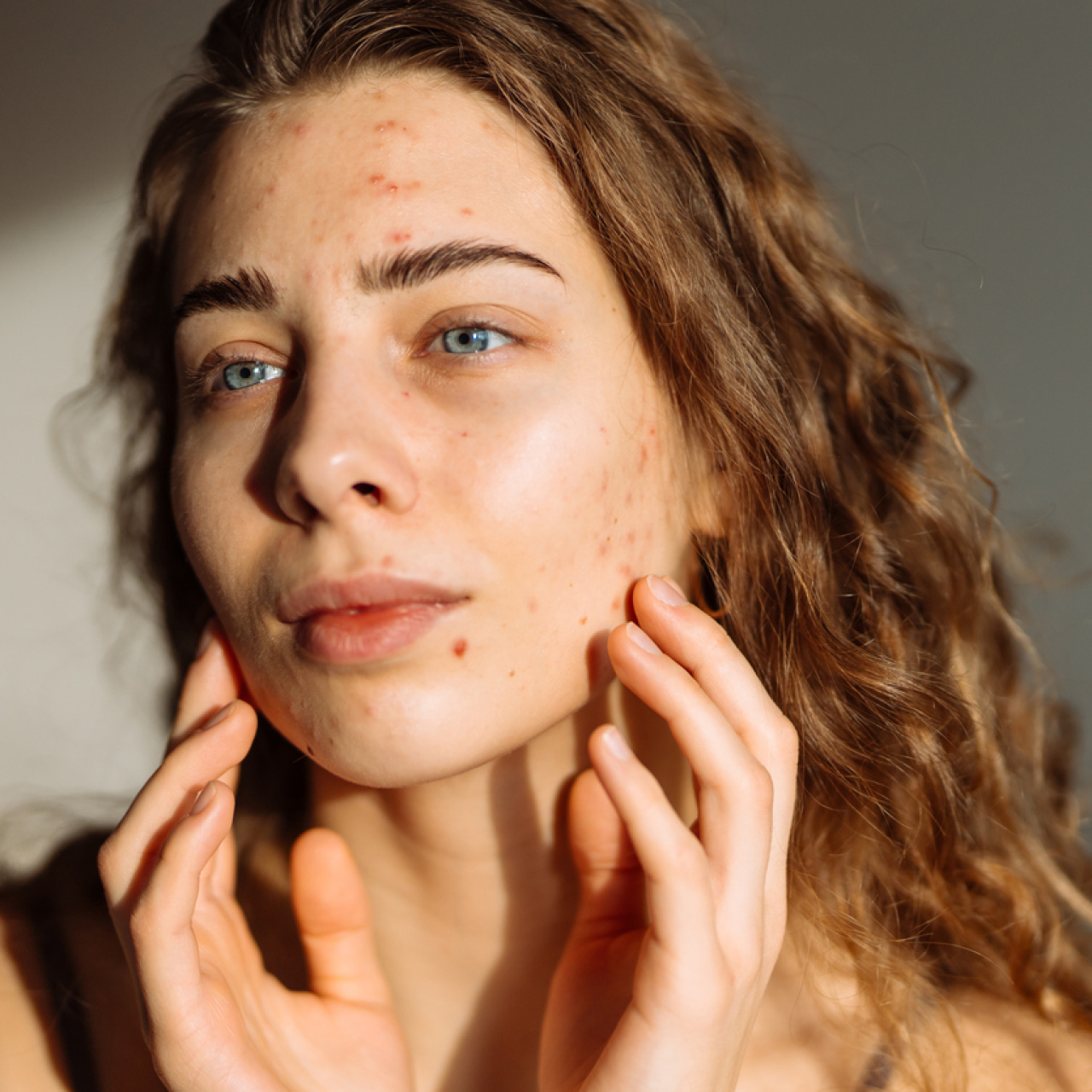 Ani akne artışını tetikleyen 14 kritik hata