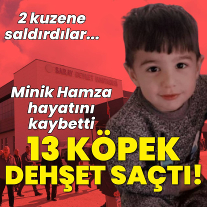 5 yaşındaydı, köpek saldırısında öldü