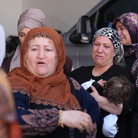 Burun ameliyatına giren genç kadın öldü!
