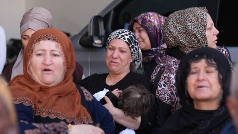 Burun ameliyatına giren genç kadın öldü!