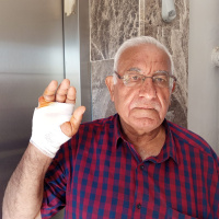 Komşusunun parmağını ısırıp koparttı!