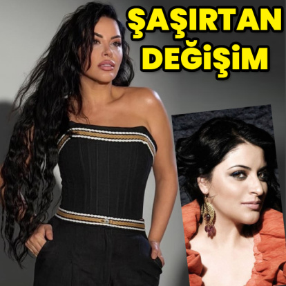 Zara'nın değişimi