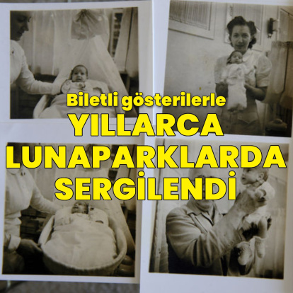 Prematüre bebekler yıllarca lunaparklarda sergilendi