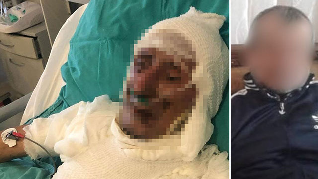 Kardeş ağabeyi ateşe vermişti! İstenen ceza belli oldu!