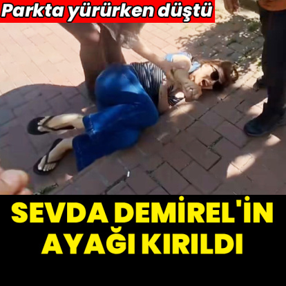 Sevda Demirel, bacağını kırdı