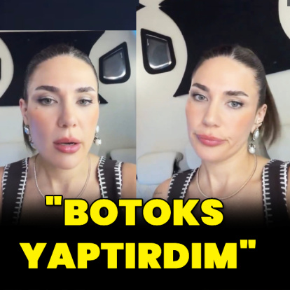"Botoks yaptırdım"