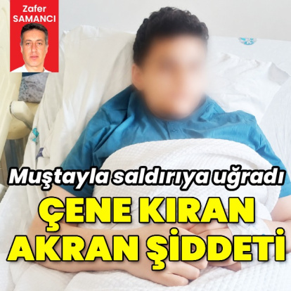 Çene kıran akran şiddeti