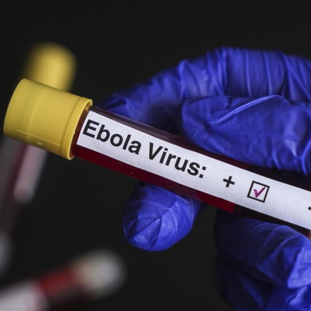 Avrupa'nın göbeğinde 'Ebola' alarmı