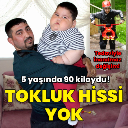 Tokluk hissi yok! 5 yaşında 90 kiloydu