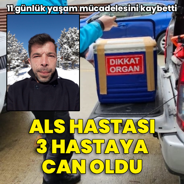 ALS hastası organ bağışıyla üç hastaya umut oldu