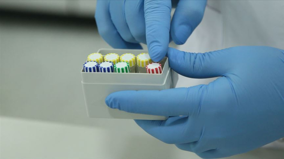Test sonuçları belli oldu