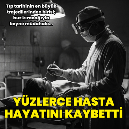 Buz kıracağıyla beyne müdahale eden doktor: Walter Freeman