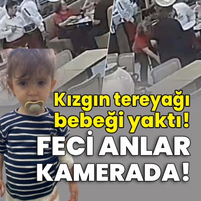 Kızgın tereyağı bebeği yaktı! Feci anlar kamerada!