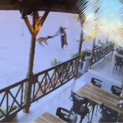 Köpek, saldırdığı kadının kolunu kopardı!