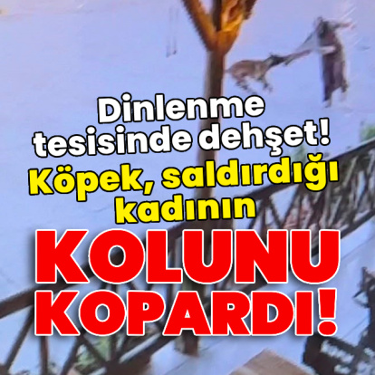 Köpek, saldırdığı kadının kolunu kopardı!