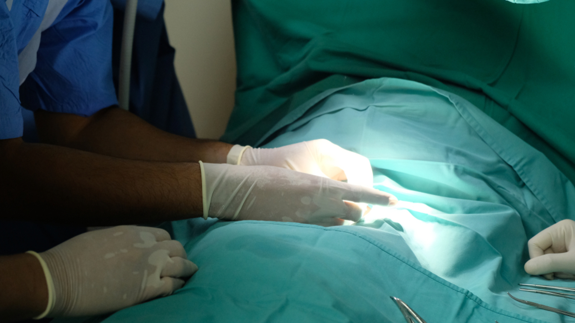 Toplu sünnetlerde enfeksiyon ve kanama riski artıyor