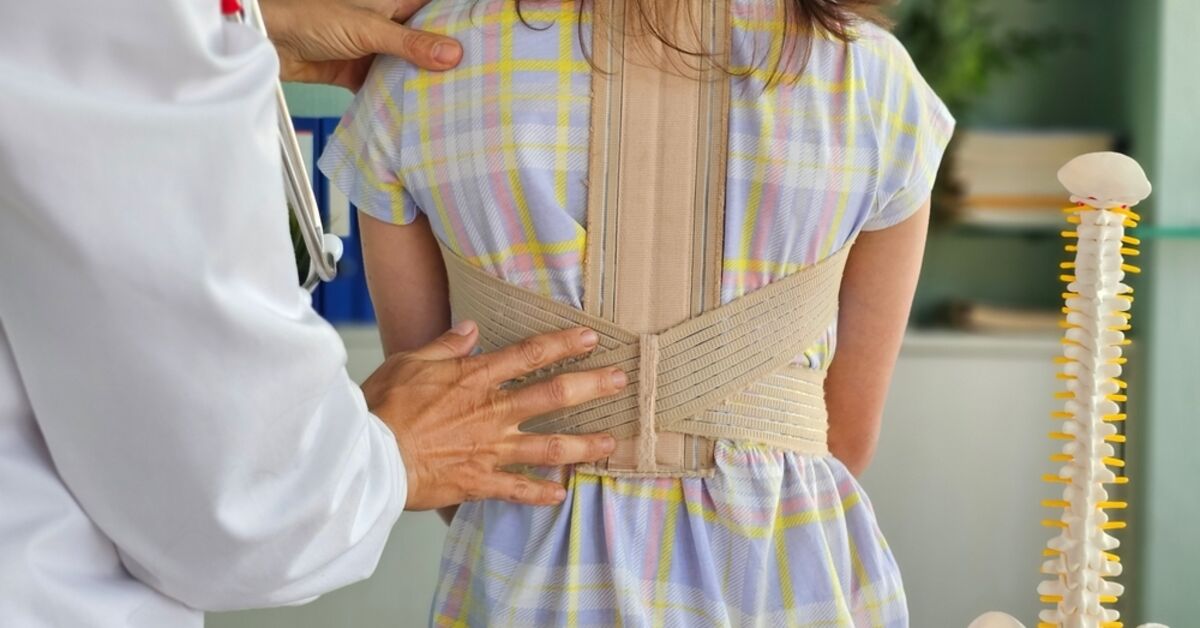 Türkiye'de büyüme çağında skolyozlu çocuk sayısı 1 milyonu aştı