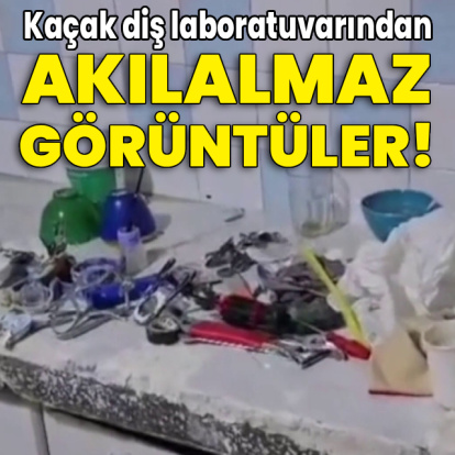Kaçak diş laboratuvarından akılalmaz görüntüler!