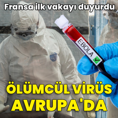 Fransa ilk Ebola vakasını açıkladı