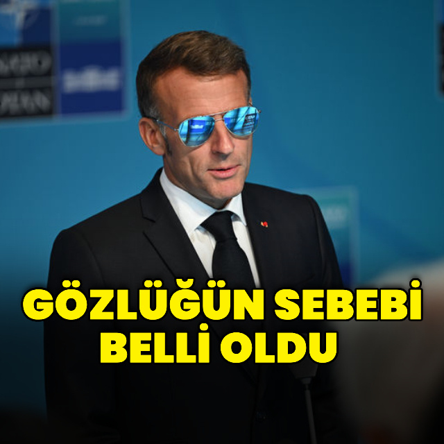 Gözündeki rahatsızlığın nedeni açıklanmıştı