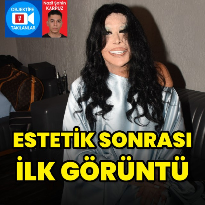 Estetik sonrası ilk görüntü