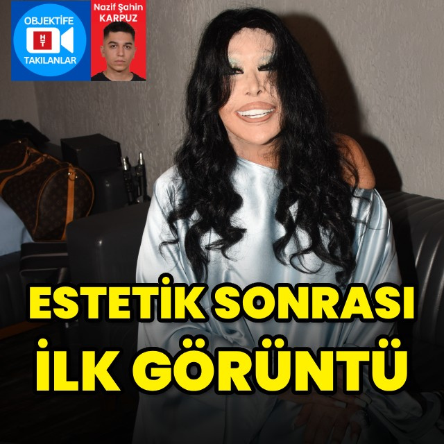 Estetik sonrası ilk görüntü
