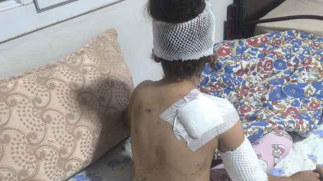150 dikiş atıldı! Şoför kurtardı