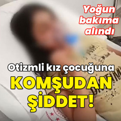 Yoğun bakıma alındı... Otizmli kız çocuğuna komşu şiddeti!
