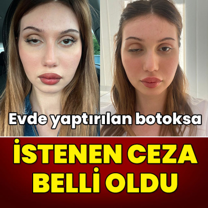 Evdeki botoksa istenen ceza belli oldu!
