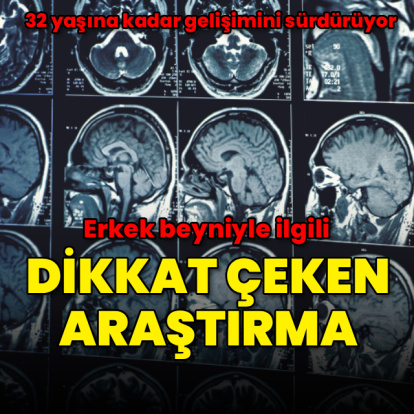 Araştırma: Erkek beyni 32 yaşına kadar gelişimini sürdürüyor