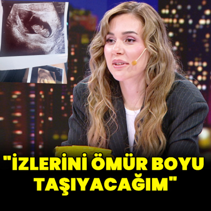 "İzlerini ömür boyu taşıyacağım"
